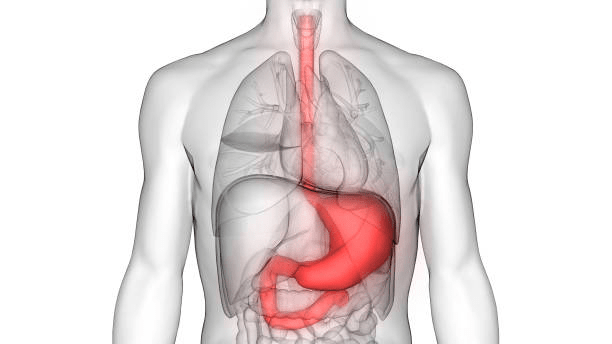 Peptic Ulcer Disease